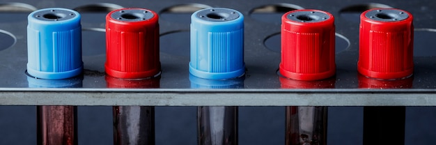 Процесс снятия старой резинки