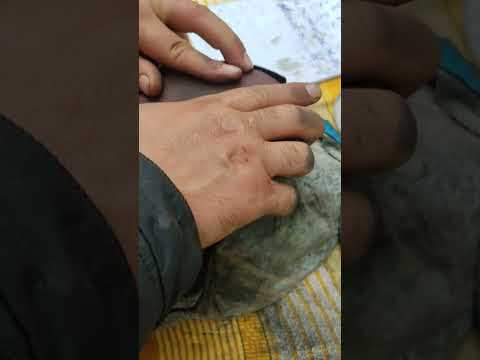 Снятие крышки Z16xep